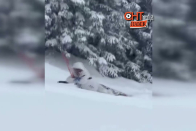 Telesiyej ile çıkarken düştü, zirveye sürünerek çıktı